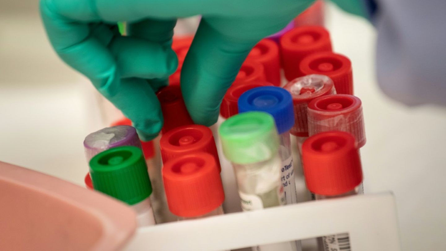 Proben in medizinischem Labor
