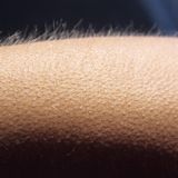 Körper: Gänsehaut