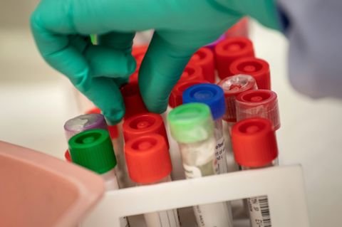 Proben in medizinischem Labor