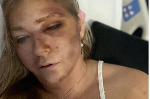 Virginia Giuffre nach ihrem Autounfall
