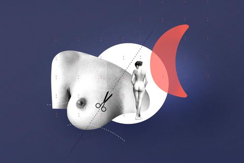Illustration, Diagnose Brustimplantat: eine Brust und eine Frau in Rückenansicht
