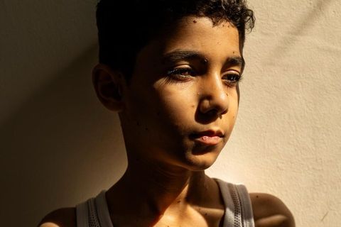 World Press Photo 2025: Portrait von dem verwundeten Mahmoud