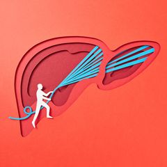 Illustration einer Fettleber, die mit einem Wasserschlauch symbolisch gereinigt wird