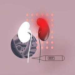 Illustration für die Diagnose Luftniere