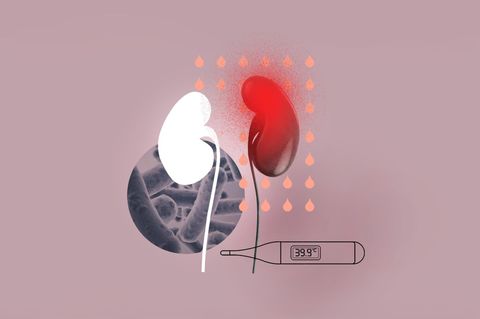 Illustration für die Diagnose Luftniere
