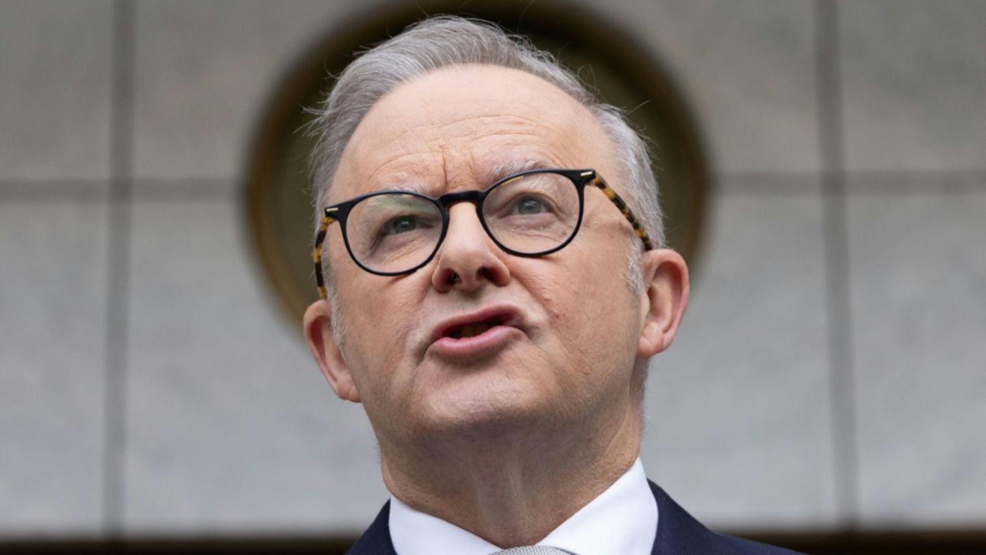Anthony Albanese