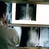 Zufall: Röntgenstrahlen