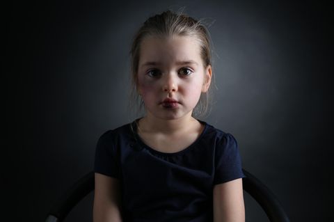 Gewalt gegen Kinder ist nie in Ordnung, auch nicht "nur ein Klaps"