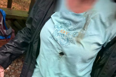 Tschechien: Deutsche Touristen vom Blitz getroffen, Foto zeigt ein Brandloch im Shirt