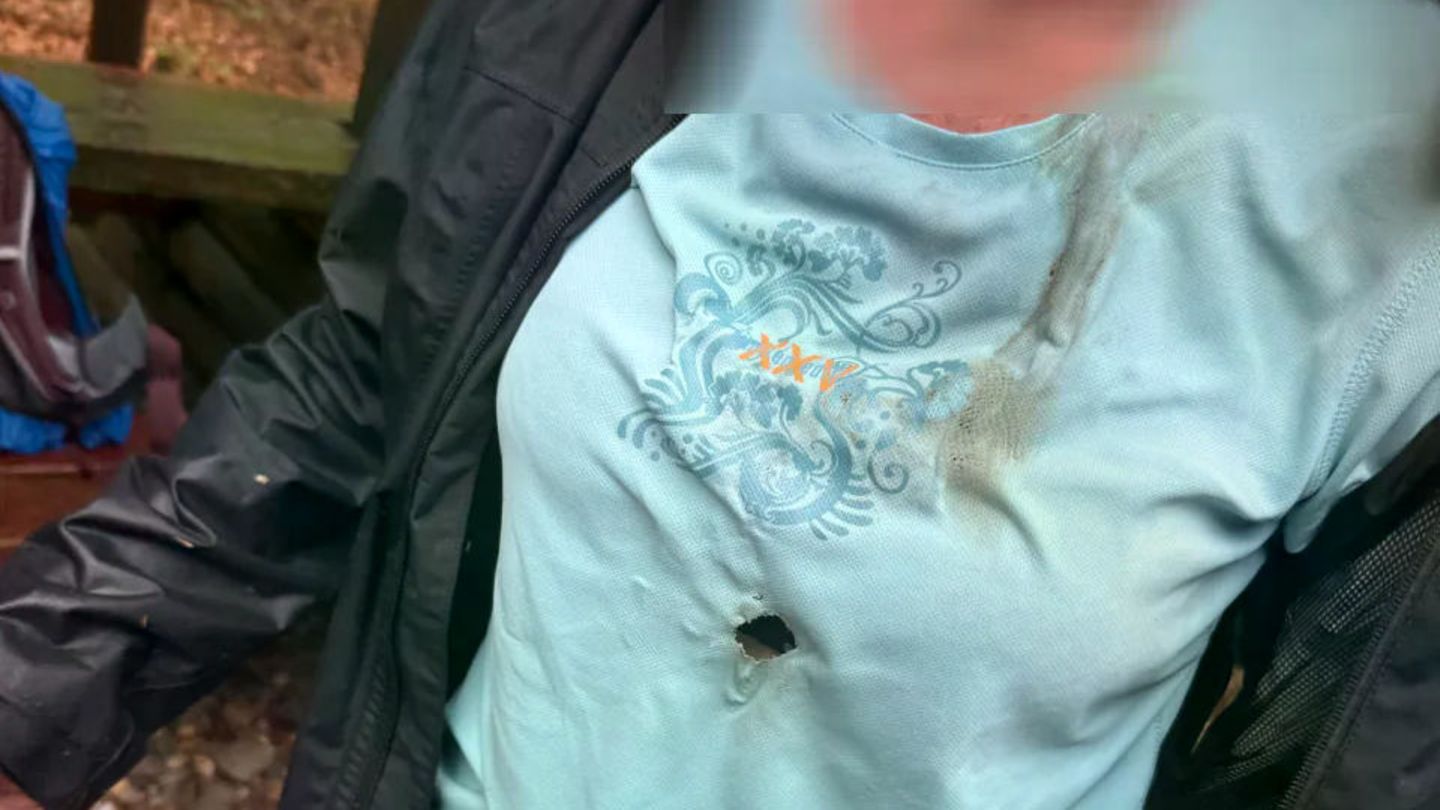 Tschechien: Deutsche Touristen vom Blitz getroffen, Foto zeigt ein Brandloch im Shirt
