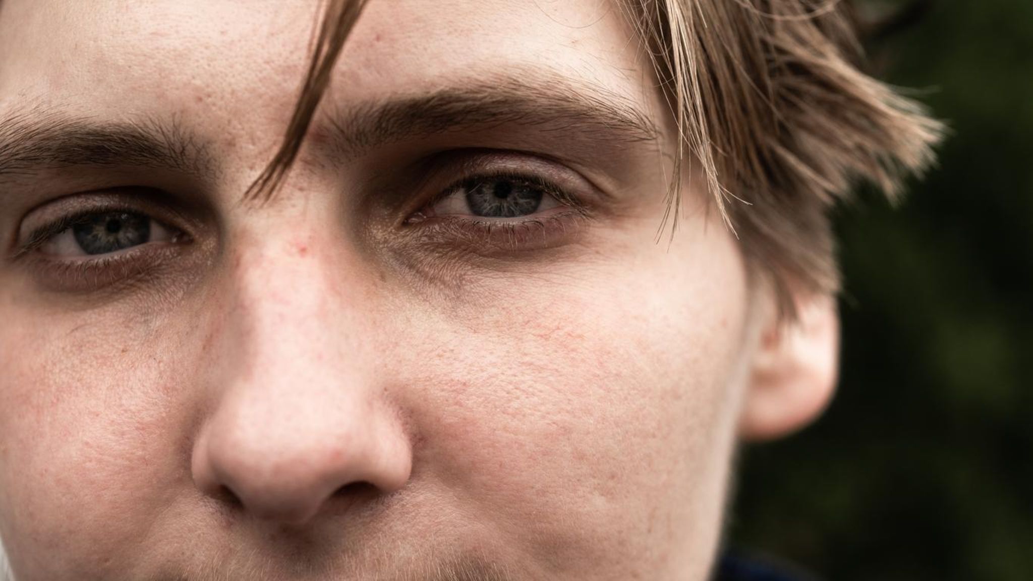 Vom Fentanyl will er nichts mehr wissen: Noah King, 26, ist seit knapp einem Jahr clean
