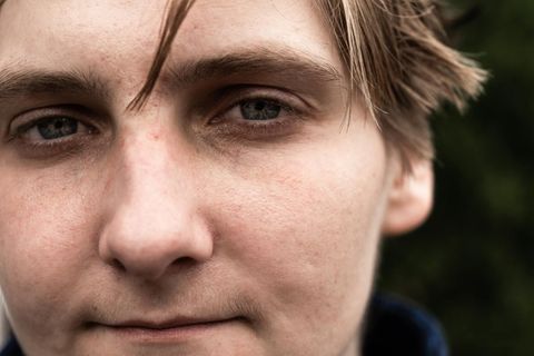 Vom Fentanyl will er nichts mehr wissen: Noah King, 26, ist seit knapp einem Jahr clean