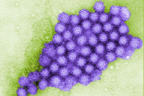 Partikel des Norovirus in einer Transmissionselektronenmikroskopie (TEM)