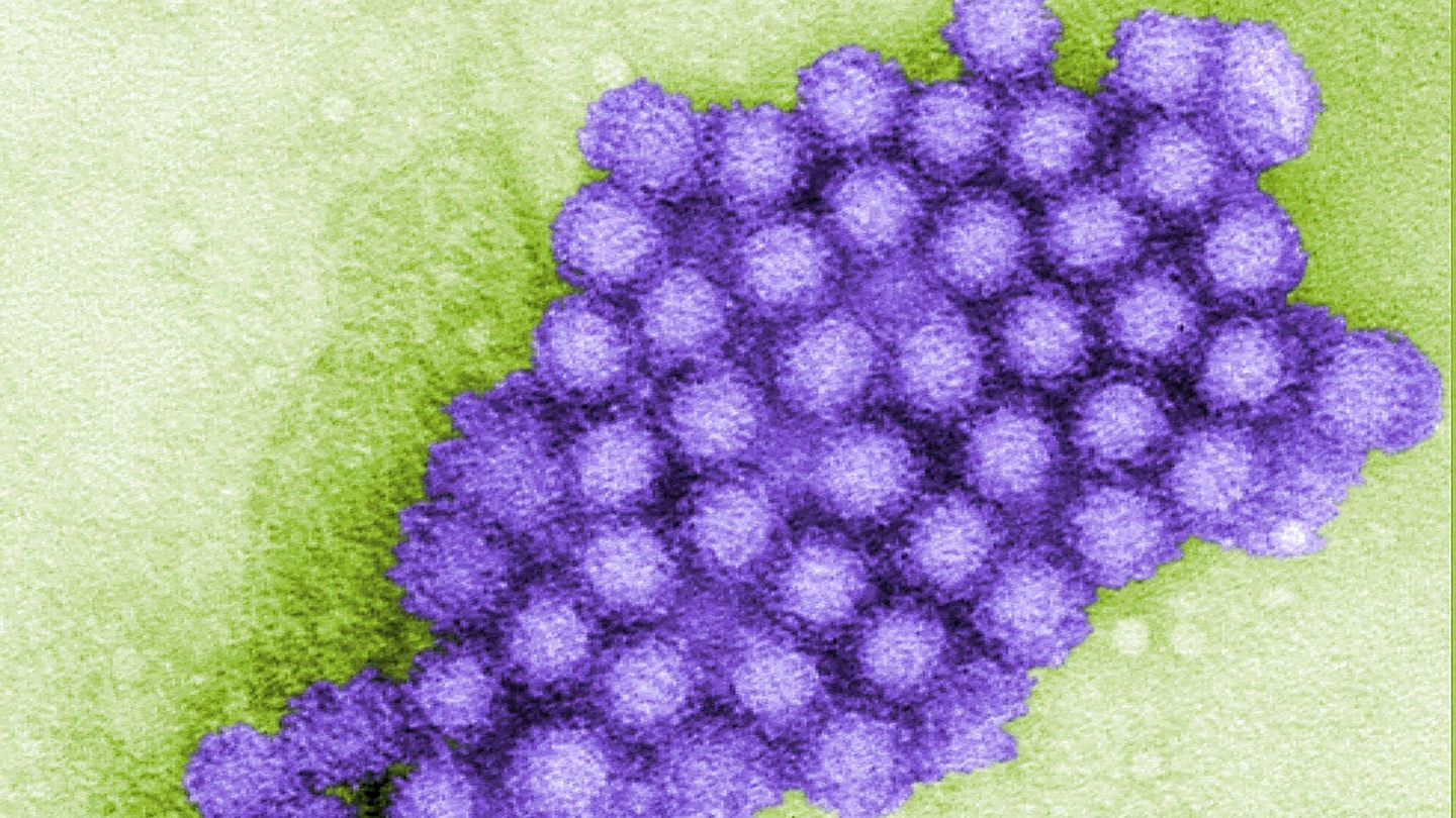 Partikel des Norovirus in einer Transmissionselektronenmikroskopie (TEM)