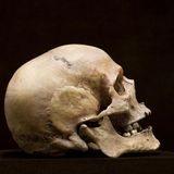 Irrtümer der Wissenschaft: Schädelform, ein Schädel vor schwarzem Hintergrund