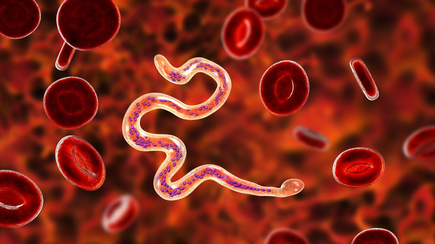 Irrtümer der Wissenschaft: Krebs durch Wurm