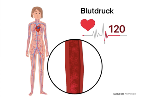 Eine Grafik veranschaulicht einige Fakten zu dem Thema Blutdruck