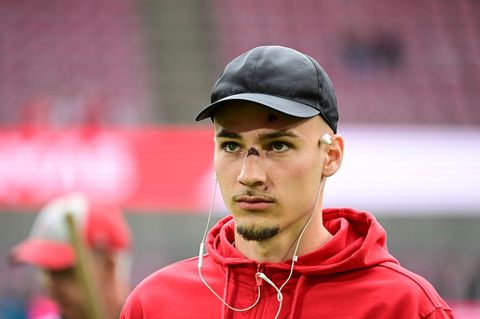 Tim Lemperle mit Verletzungen im Gesicht