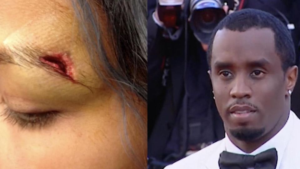 Diese schockierende Bilder setzen US-Rapper "P. Diddy" weiter unter Druck