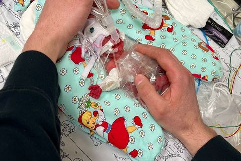 Etwas mehr als ein Päckchen Butter wog die kleine Marie, als sie im Februar zur Welt kam. Seitdem ist das Baby gut gewachsen