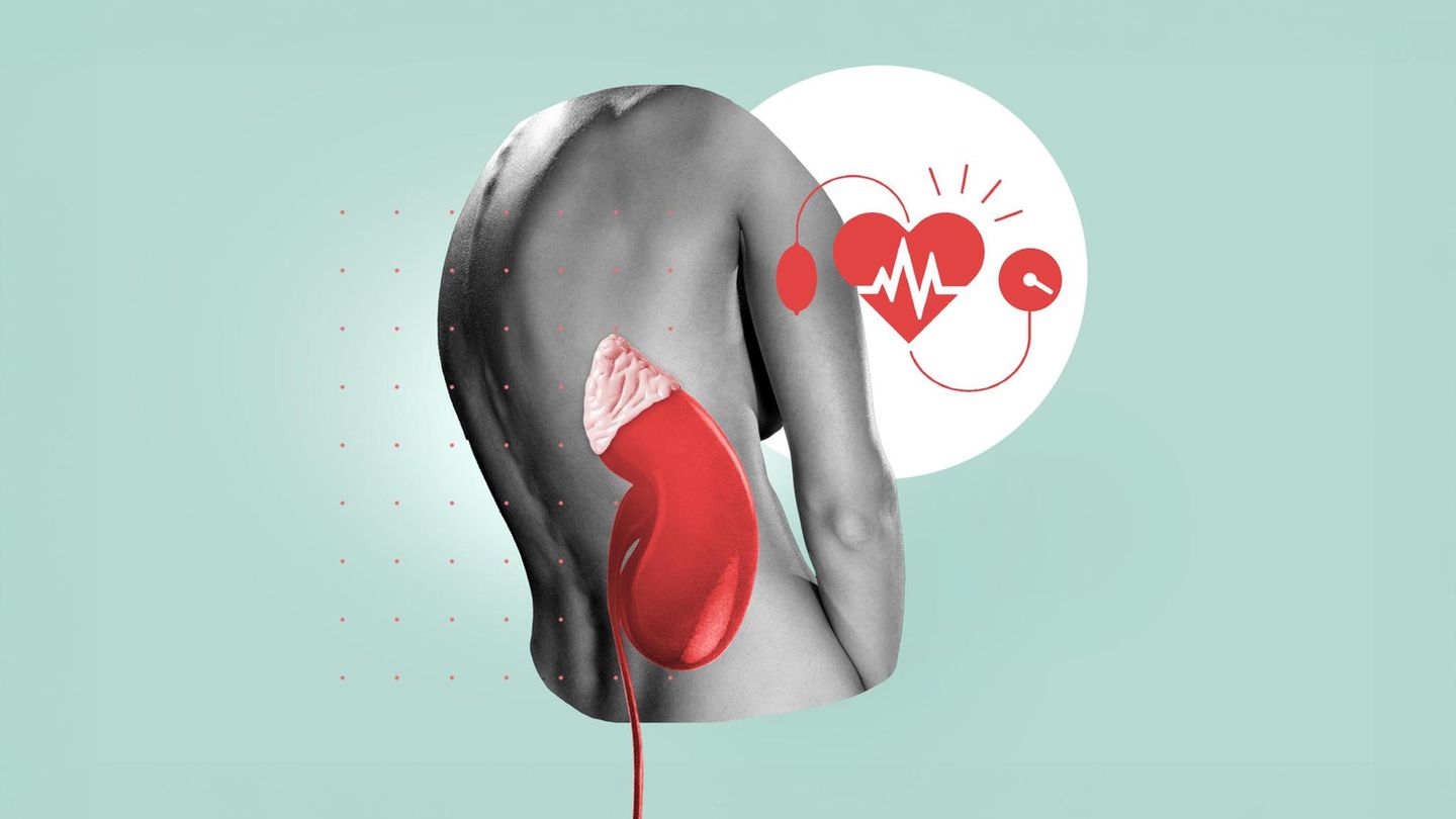 Diagnose Conn-Syndrom und hoher Blutdruck: Illustration eines Rückens und einer Nebenniere