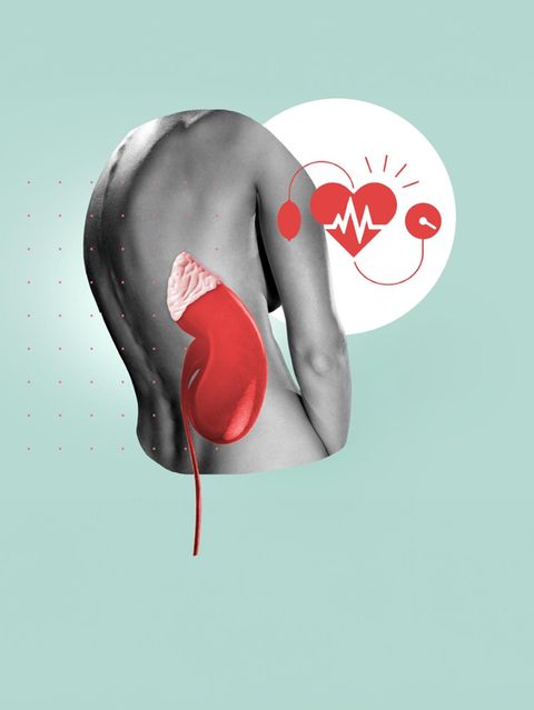 Diagnose Conn-Syndrom und hoher Blutdruck: Illustration eines Rückens und einer Nebenniere