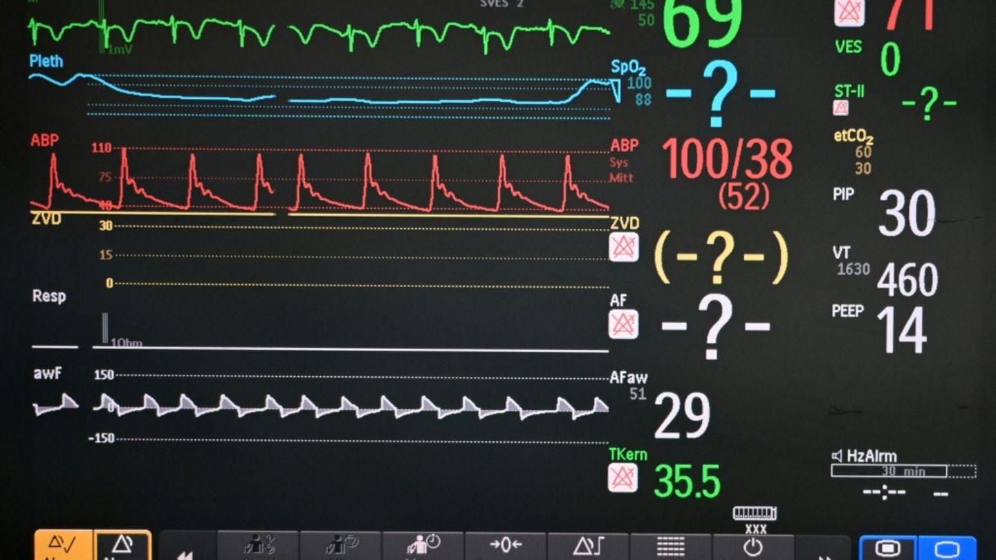 Patientenmonitor in Krankenhaus