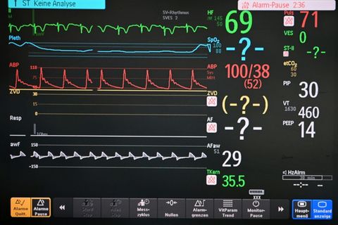 Patientenmonitor in Krankenhaus