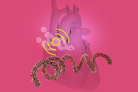 Atemnot eines Patienten: Illustration eines Herzens, eines Paares beim Sex und eines Bakteriums