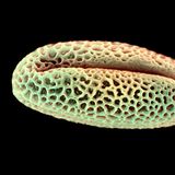 Weide Pollen rasterelektronenmikroskopische Aufnahme