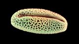 Weide Pollen rasterelektronenmikroskopische Aufnahme