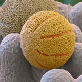 Primel Pollen rasterelektronenmikroskopische Aufnahme