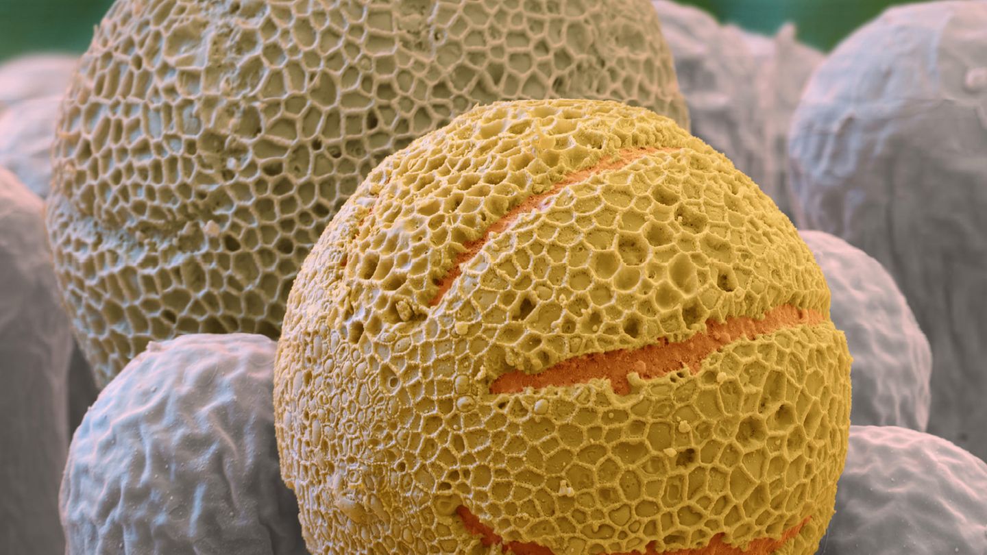 Pollen unter dem Mikroskop Faszinierende Plagegeister | STERN.de