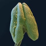 Linde Pollen rasterelektronenmikroskopische Aufnahme