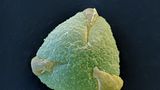 Eiche Pollen rasterelektronenmikroskopische Aufnahme