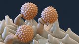 Beifuss Pollen rasterelektronenmikroskopische Aufnahme