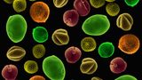 Pollen, rasterelektronenmikroskopische Aufnahme