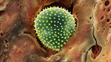 Pollen im Nasenhaar rasterelektronenmikroskopische Aufnahme