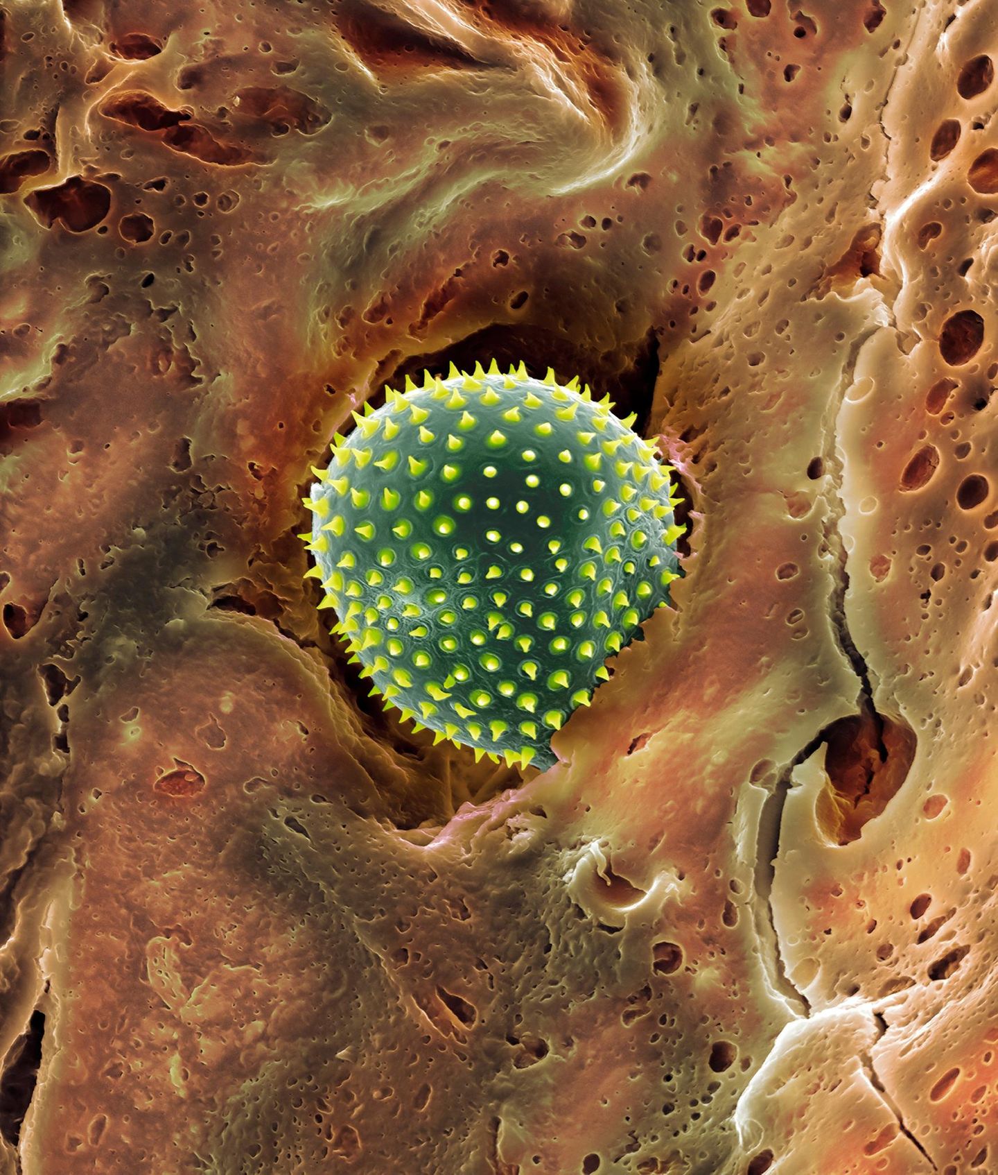 Auf der Nasenschleimhaut Pollen im Nasenhaar rasterelektronenmikroskopische Aufnahme