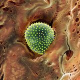 Pollen im Nasenhaar rasterelektronenmikroskopische Aufnahme