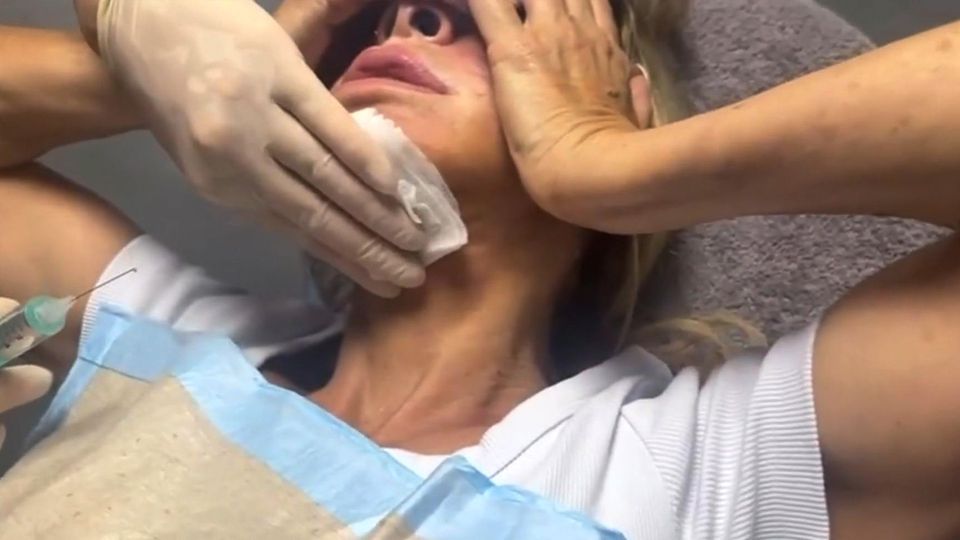 "Was hat er mir angetan?": Carmen Geiss zeigt Überfall-Verletzungen "Was hat er mir angetan?": Carmen Geiss zeigt Überfall-Verletzungen