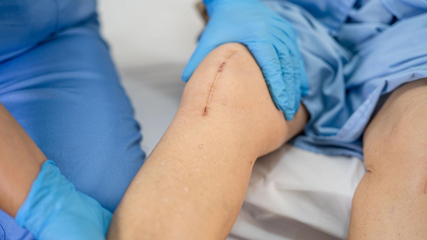 Wir nennen Ihnen ausgezeichnete Kliniken für Endoprothetik