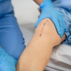 Wir nennen Ihnen ausgezeichnete Kliniken für Endoprothetik