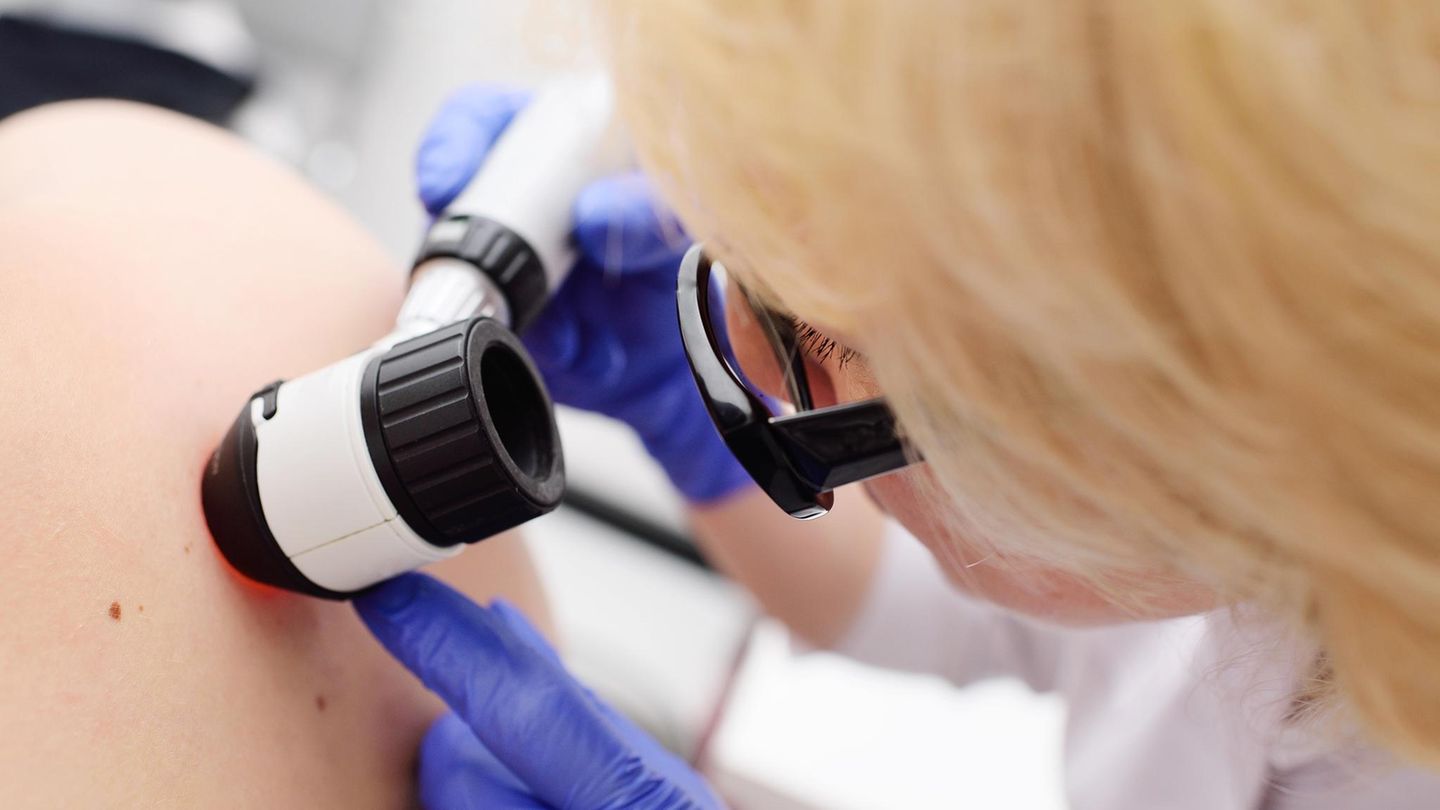 Wir nennen Ihnen ausgezeichnete Kliniken im Bereich Hautkrebs