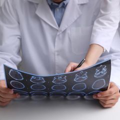 Wir nennen Ihnen ausgezeichnete Kliniken für Multiple Sklerose