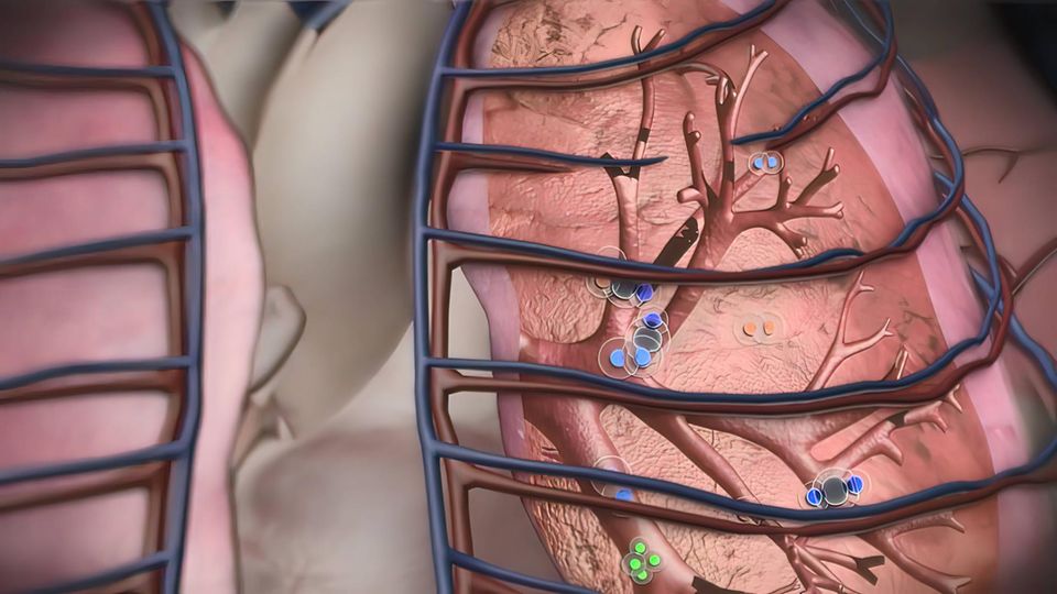 Illustration Atmung: Das Zwerchfell senkt sich, Rippen und Brustkorb weiten sich aus