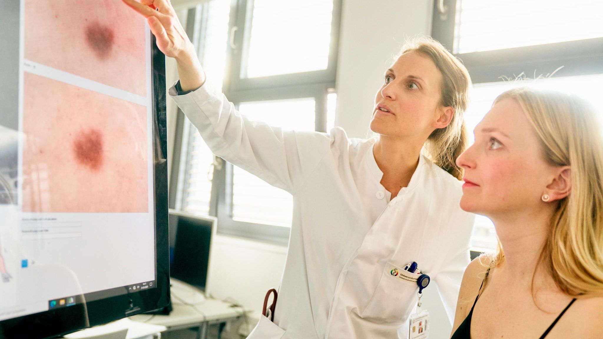 Hautkrebs: Hautärztin analysiert Aufnahmen von auffälligen Leberflecken