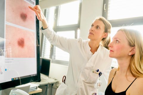 Hautkrebs: Hautärztin analysiert Aufnahmen von auffälligen Leberflecken