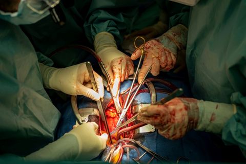 Ärzte bei Herztransplantation in Spanien