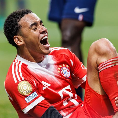 FC Bayern: Jamal Musiala operated successfully and before rehabilitation start